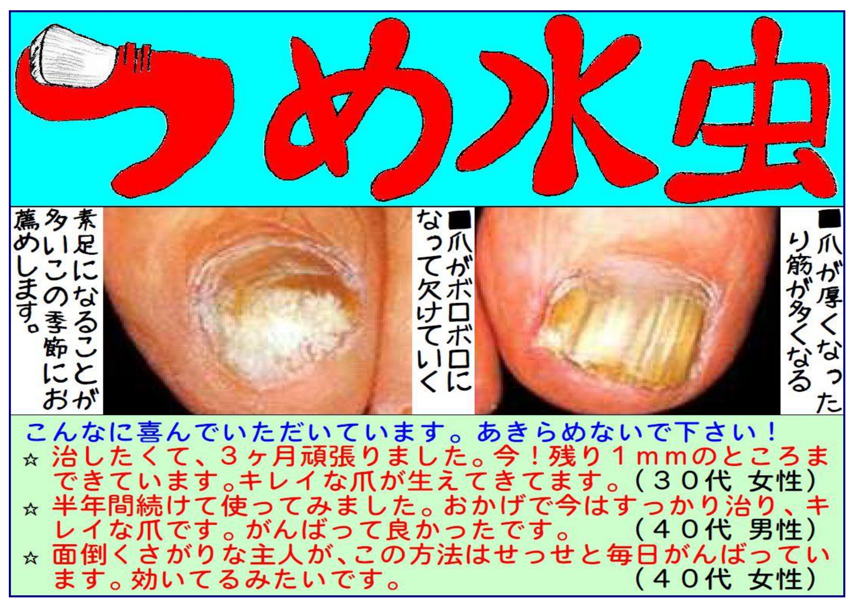 つめ水虫チラシ